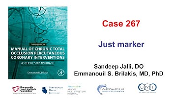 Case 267: Manual of CTO PCI - Just marker