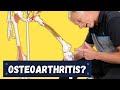 What is Causing Your Knee Pain? Osteoarthritis? How to Tell