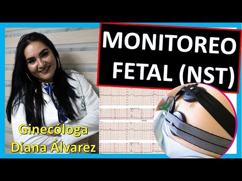 Video: ¿Qué es un NST reactivo en el embarazo?