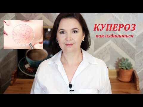 КУПЕРОЗ ||Секреты правильного ухода || Как избавиться от сосудистой сеточки на лице