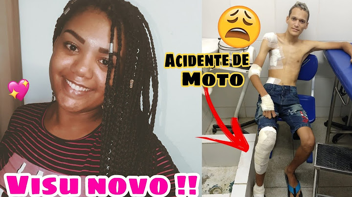Vlog: Charles sofreu um acidente de moto, 😭 Cabelo novo e muito mais.. 💜