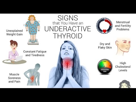 Signs of hyperthyroidism