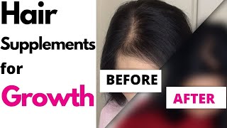 Hair Supplements for Growth - Did it work