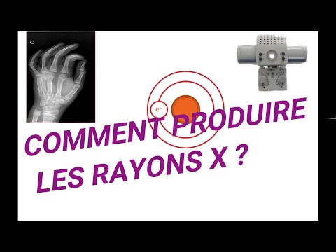 Vidéo: De quoi sont faits les rayons X ?