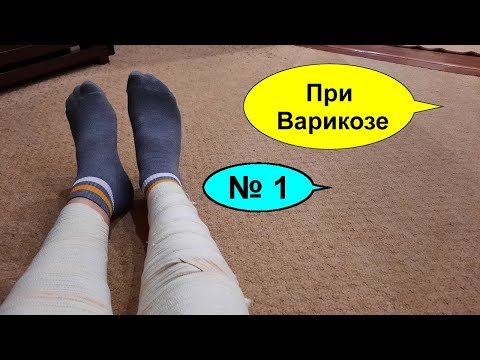 Варикоз - варикозное расширение вен народное лечение - средство от варикоза № 1
