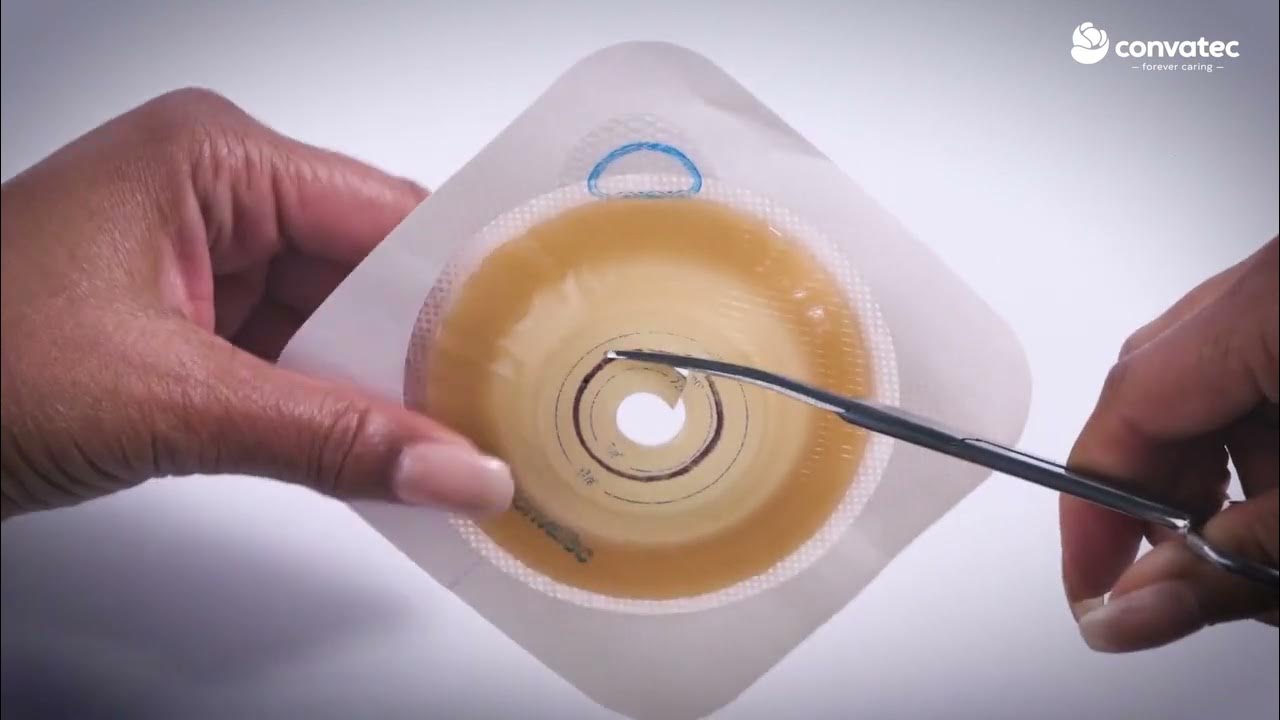 How to Apply a Cuttofit Stoma System YouTube