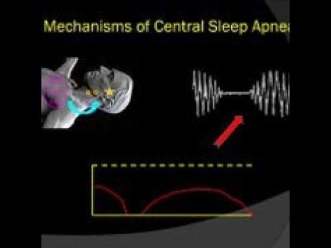 Understanding Mechanisms of Central Sleep Apnea - BAVLS