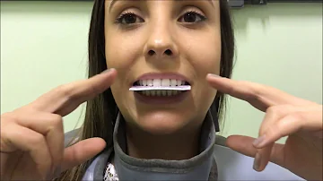 Como deverá ser posicionada a cabeça do paciente para a realização de radiografia oclusal total da mandíbula?