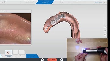 Scanning a Denture with CEREC PrimeScan 5.1.1