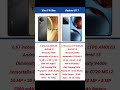 Vivo T4 Ultra vs Realme GT 7 Comparison #shorts #short #vivot4ultra #realmegt7