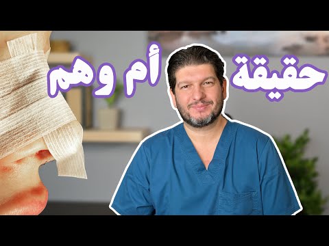 لصقات الأنف لتصغيره بعد العملية