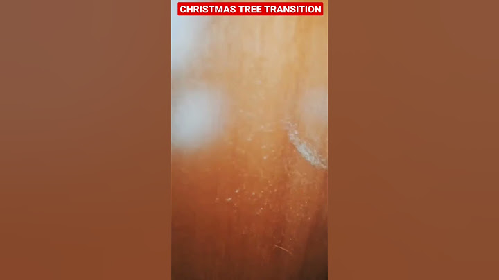 CHRISTMAS TREE Transition Trend! Papy lancia la palla di Natale come una bomba e Sofy scappa😂#shorts