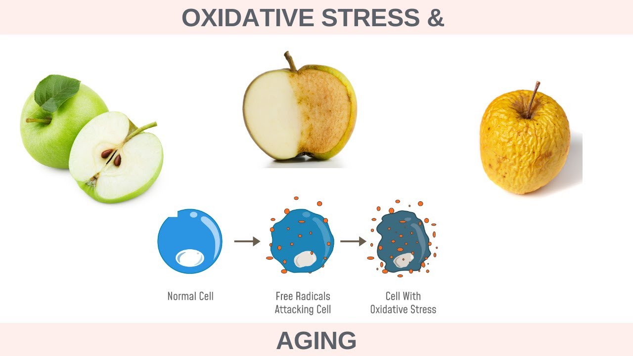 Oxidative Stress & Aging - Mikel Kristi