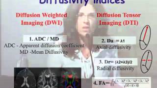 (Part 1/2) TBSS study of young children with Autism: whole brain...