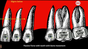 Biological basis of tooth movement