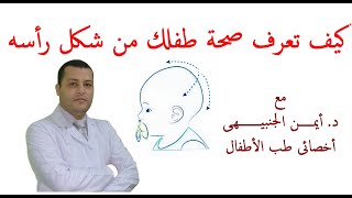 كيف تعرف صحة طفلك من شكل رأسه