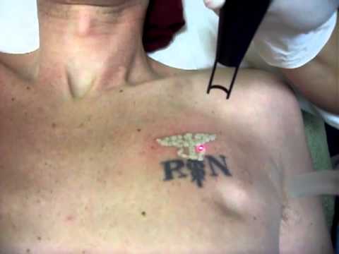 RN tattoo on chest - YouTube