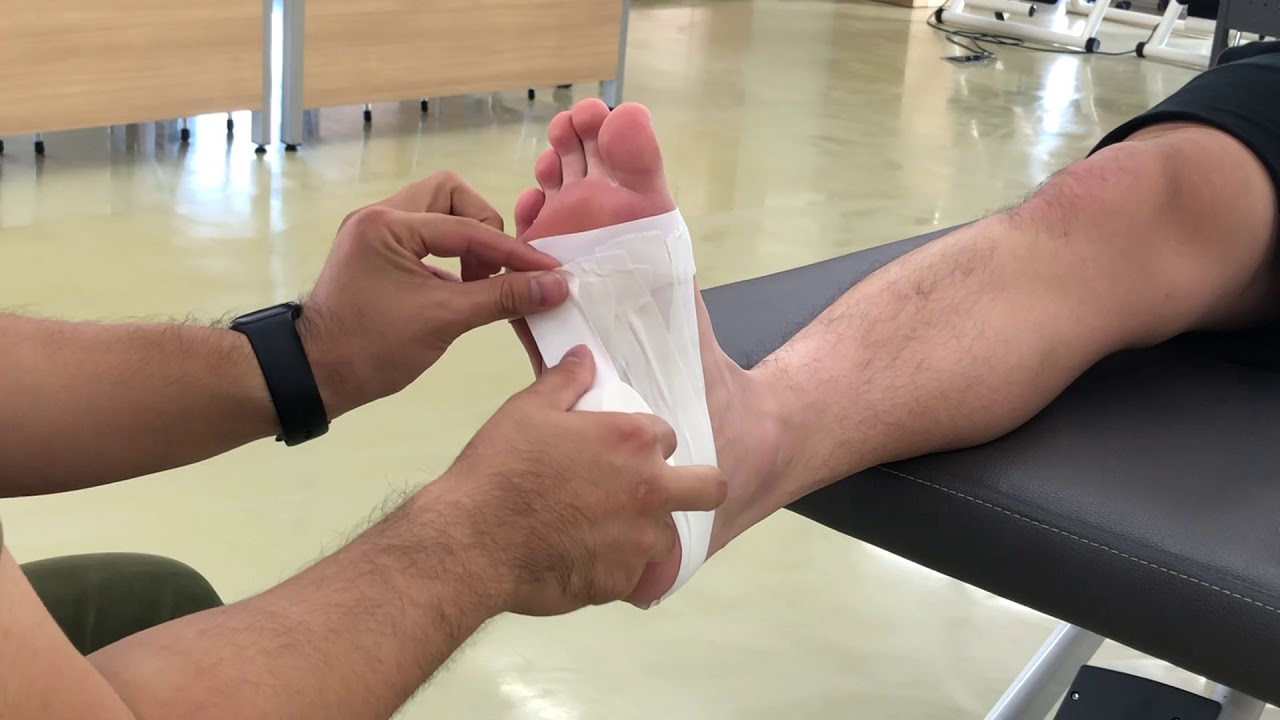 [스포츠 테이핑] Foot Plantar fasciitis taping YouTube