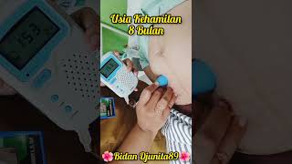 Denyut Jantung Janin Usia Kehamilan 8 Bulan