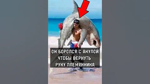 Этот Человек Боролся С Акулой, Чтобы Вернуть Руку Своего Племянника!
