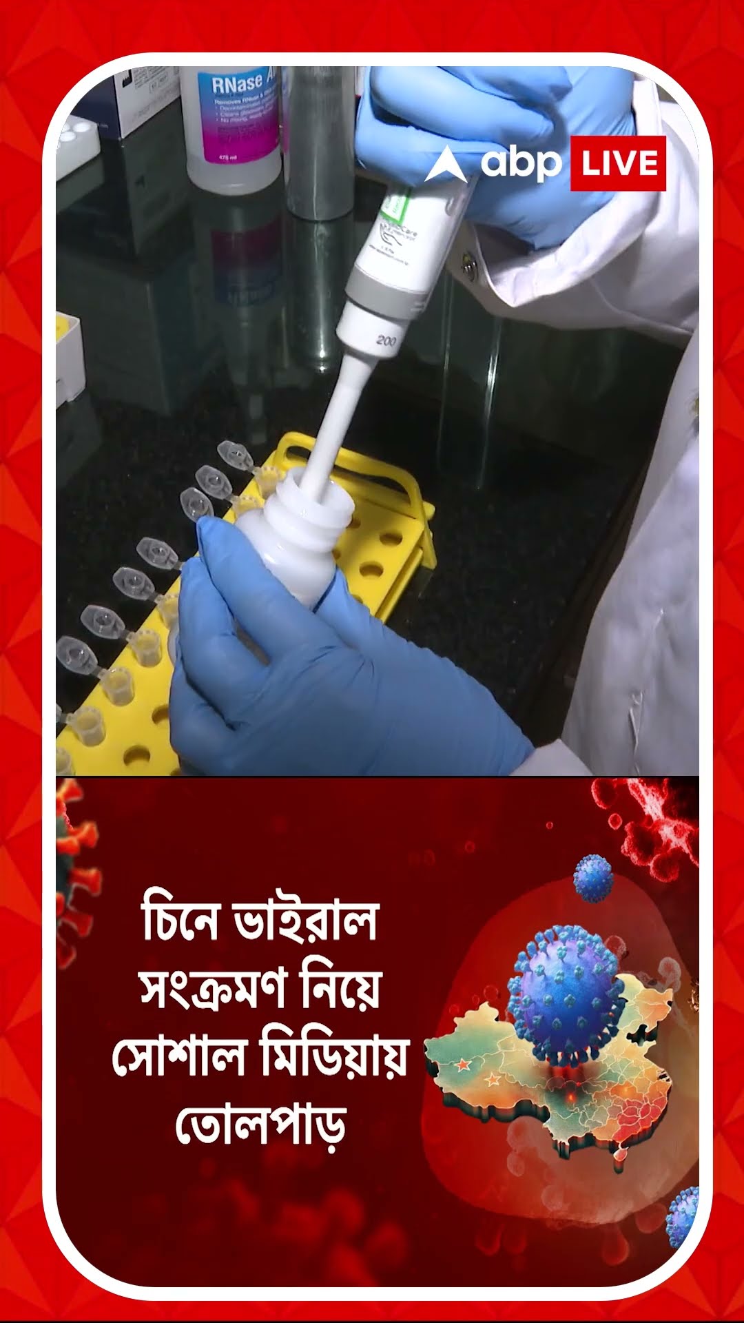 চিনে HMPV সংক্রমণে বেশি আক্রান্ত শিশু থেকে কিশোর, উপসর্গ কী কী?