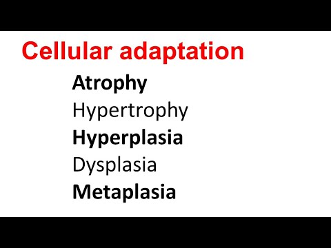 Cellular Adaptation | Atrophy Hypertrophy Hyperplasia Dysplasia Metaplasia |