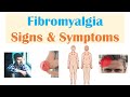 Fibromyalgia | Signs & Symptoms, Associated Conditions