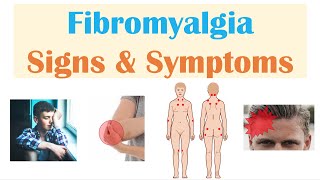 Fibromyalgia | Signs & Symptoms, Associated Conditions - YouTube