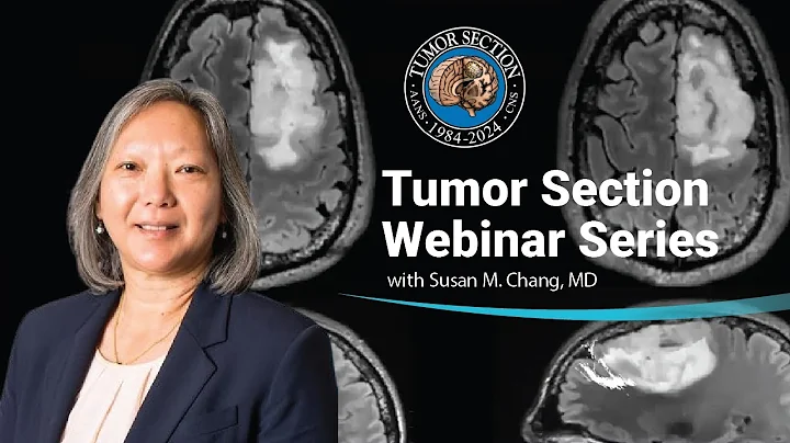 IDH Wildtype Glioma – Updates on Treatment with Susan Chang, MD