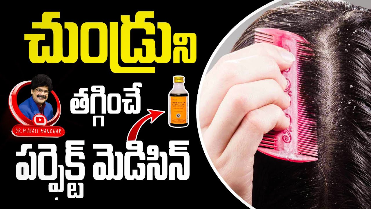 చుండ్రును తగ్గించే పర్ఫెక్ట్ మెడిసిన్ |10 Home Remedies to Get Rid of Dandruff Naturally| #dandruff