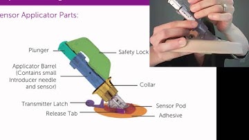 Dexcom G5 — Training Webinar — How To Insert Your Sensor