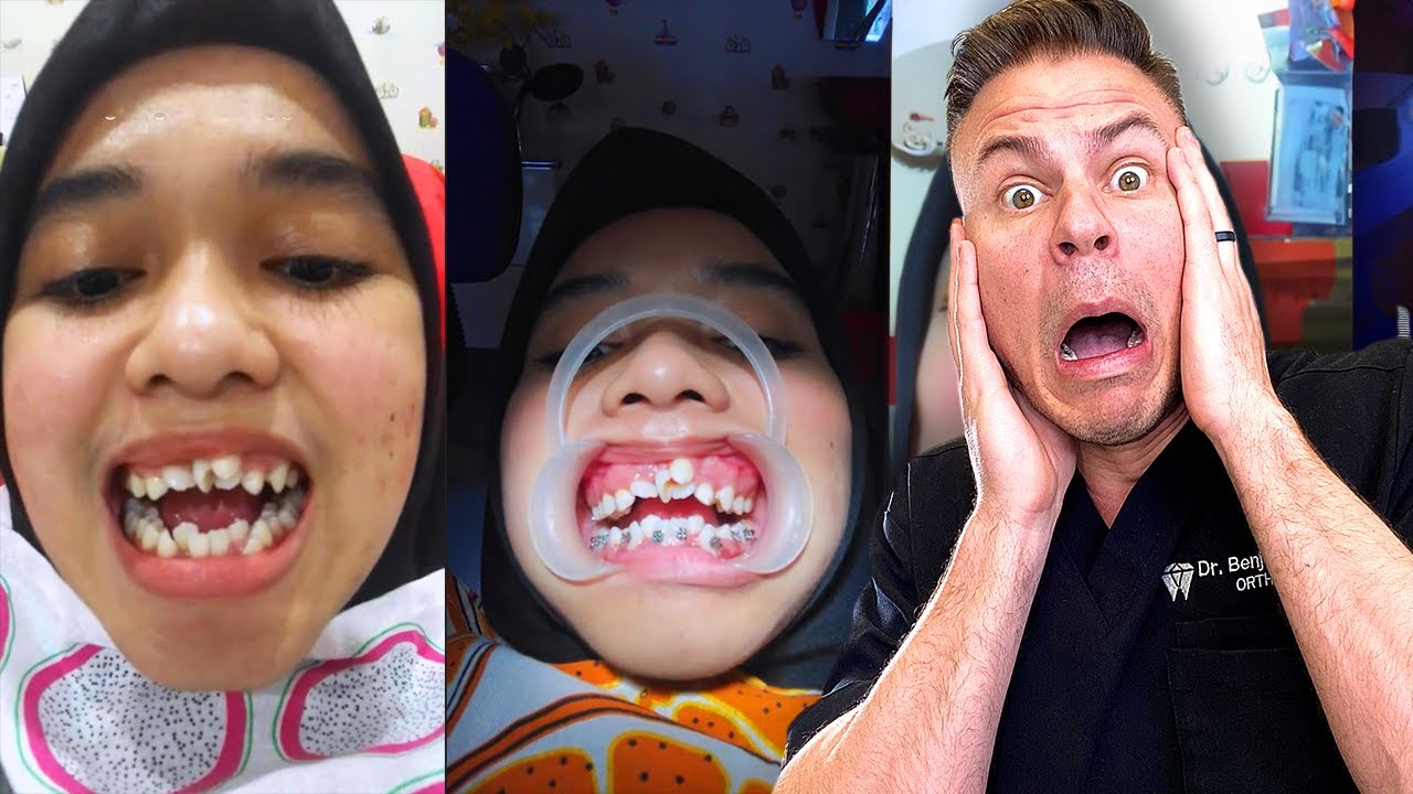 Can A Dentist Fix This WITHOUT Pulling Teeth?!