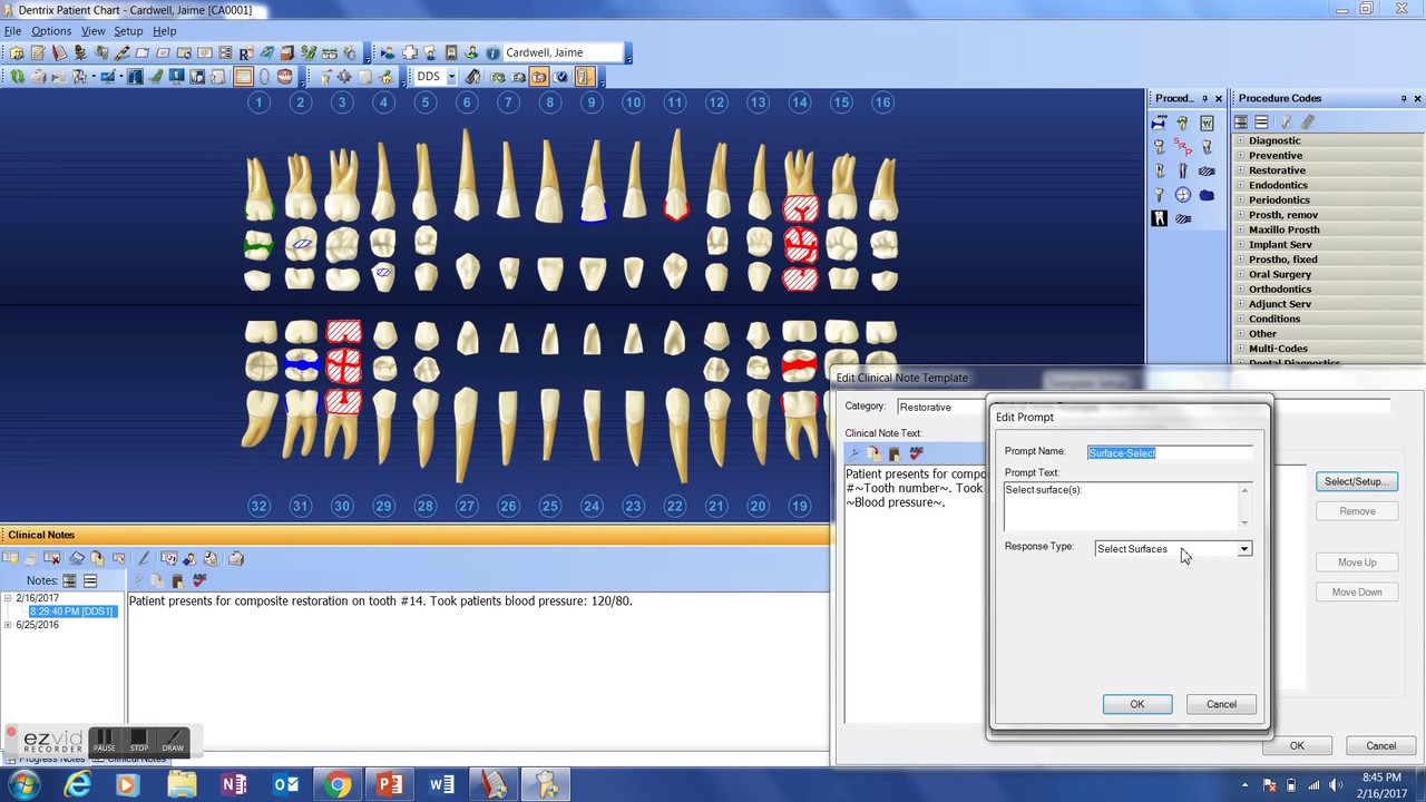 Dentrix Tooth Chart