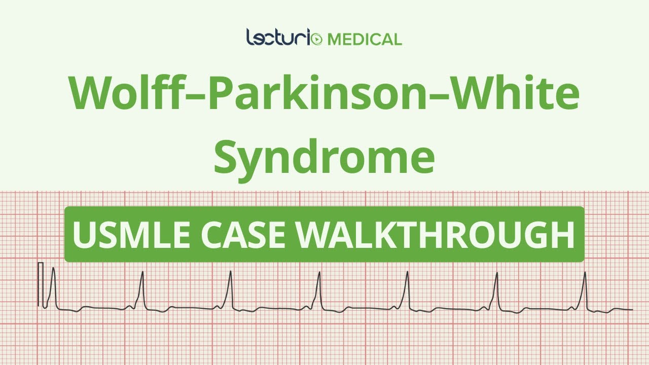 Разбор случая ЭКГ при синдроме Вольфа-Паркинсона-Уайта.
