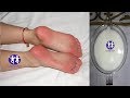 how to whiten feet instantly Special feet whitening pedicure at home Beautiful feet spa and tips