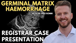 Germinal Matrix Haemorrhage | Cranial Ultrasound | Registrar Sessions
