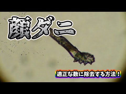 顔ダニの除去方法→ニキビのもとになるダニはこうして駆除せよ！