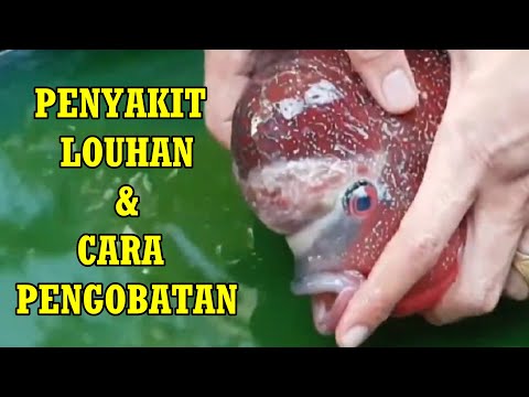 Video: Cara Menghapus Booger Dalam, Dan Apa Penyebabnya