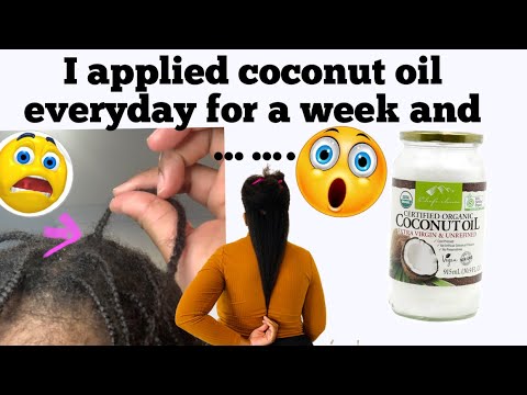I APPLIED COCONUT OIL EVERYDAY for 9 DAYS ON MY HAIR & SCALP AND THIS HAPPENED!I’m STILL SHOCKED 😮