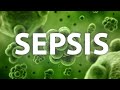 Sepsis Case Discussion