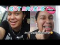 COME WITH ME TO GET BRACES!!! | vlog