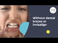Ellesse’s Clip On Veneers | Straighter Smile | Instasmile Review