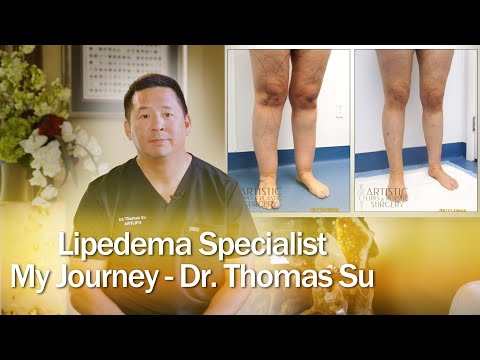 Lipedema Surgery Liposuction | Expert Dr. Thomas Su | ArtLipo