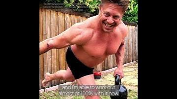 Stories of Transformation | Shoulder Surgery Recovery