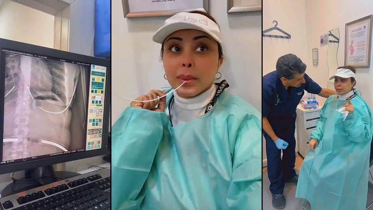 ابرار الكويتية تسوي بالون المعدة بعدما زاد وزنها 15 كيلو🙊