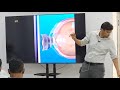 Diabetic Retinopathy & Dibaetic Kidney Disease