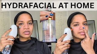 hydrafacial at home ( before and after treatment)