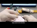 RelyX u 200 cementation on zirconia crown | pinkblue