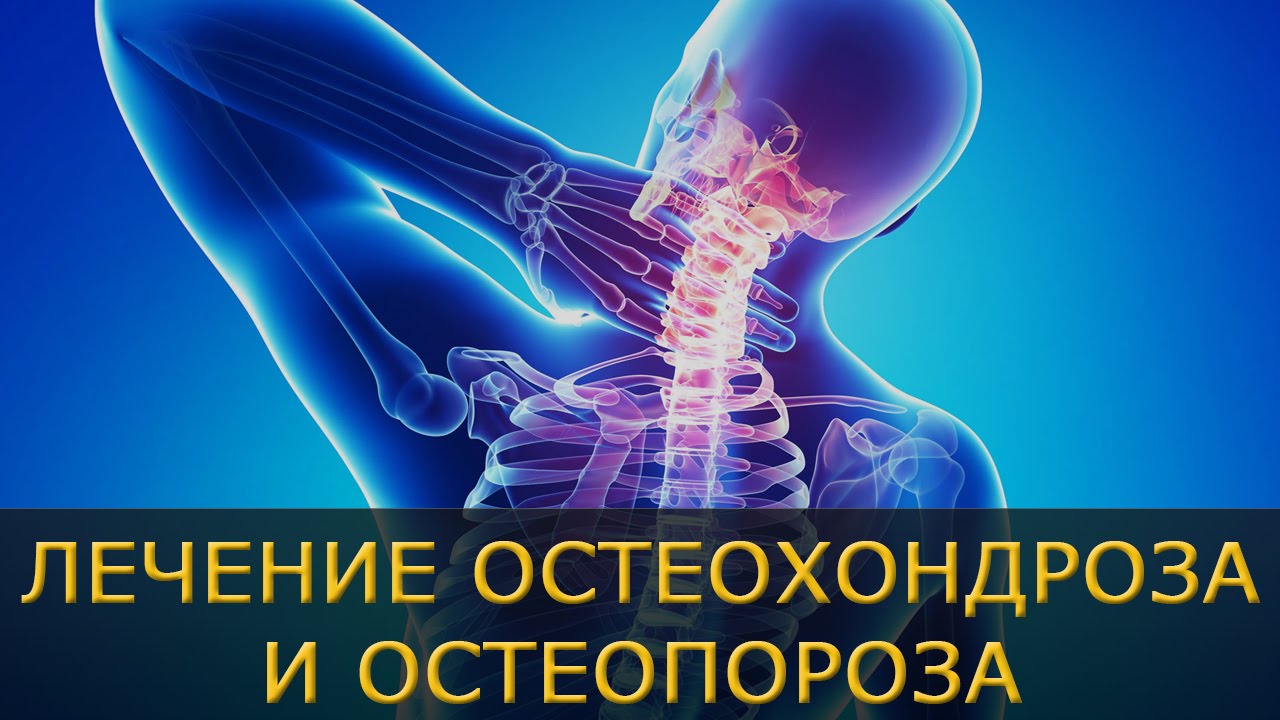 Как вылечить остеохондроз. Симптомы, диагностика и лечение остеопороза ...