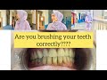 DO U BRUSH PROPERLY?? | Aggressive teeth brushing | Dentist